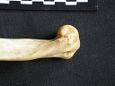 Humerus: distal part