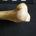 Humerus: proximale part