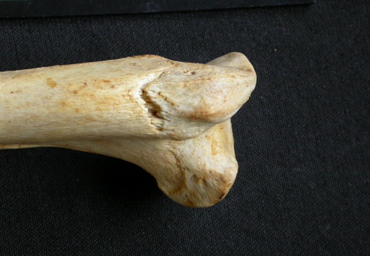 Humerus: proximale part