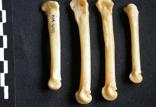 Metacarpals