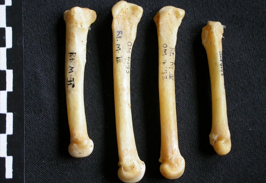 Metacarpals