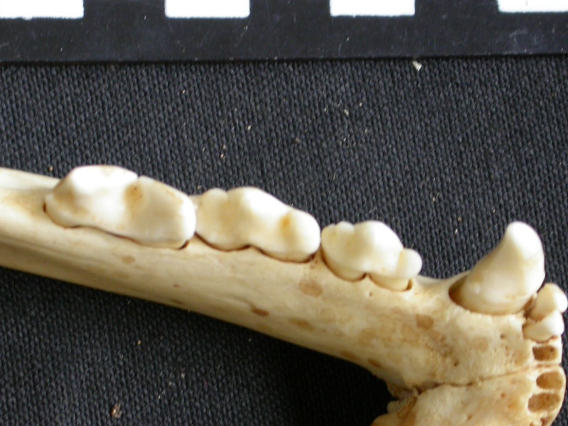 Dentition inférieure