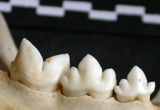 Lower teeth