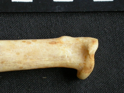 Radio : parte proximal