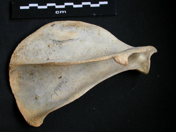 Scapula : vue latérale