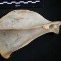 Scapula : vue latérale