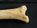  Tibia: distal part