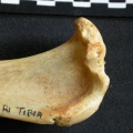 Tibia : partie proximale