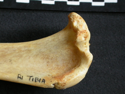 Tibia: parte proximal