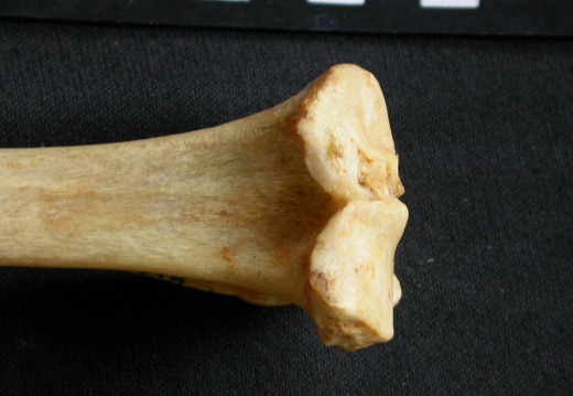  Tibia: proximale part