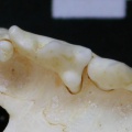 Dentition supérieure