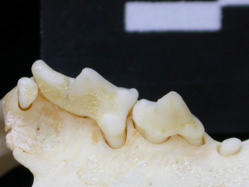 Dentition supérieure