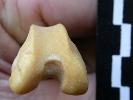 Fémur : partie distale