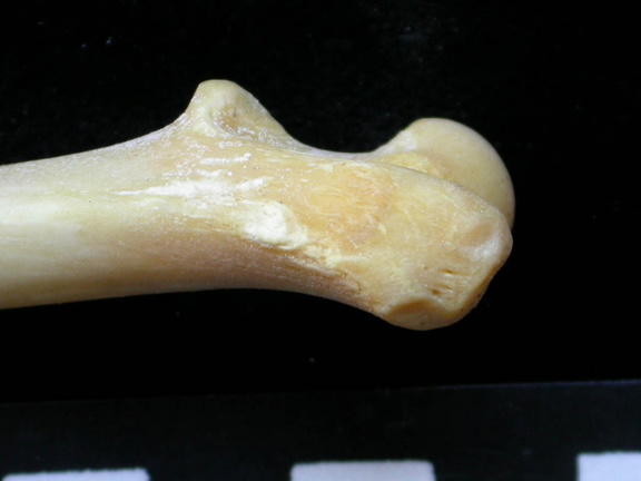 Fémur : partie proximale