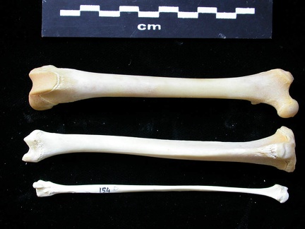 Fémur, tibia et fibula