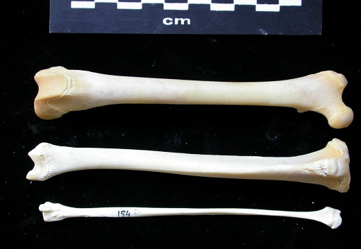  Femur, tibia and fibula