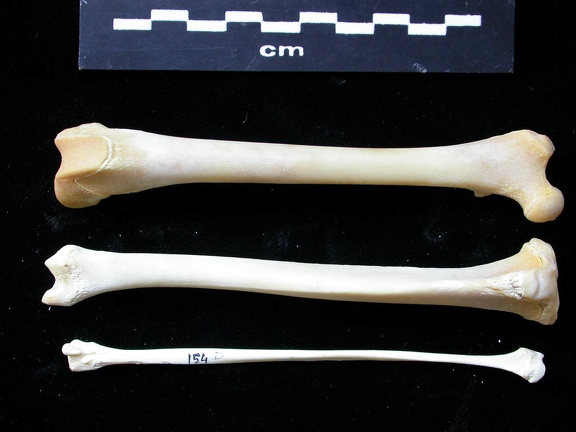  Femur, tibia and fibula