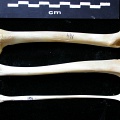  Femur, tibia and fibula