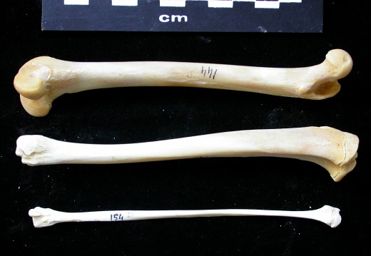  Femur, tibia and fibula