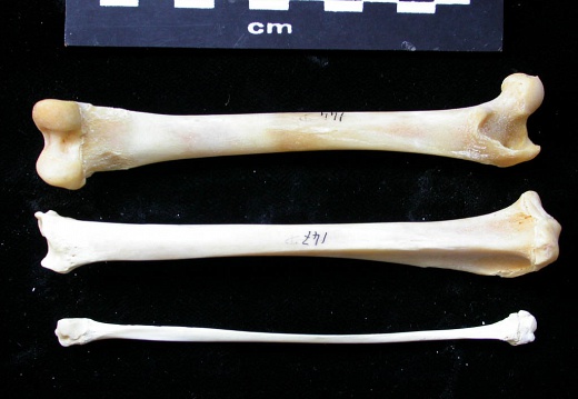  Femur, tibia and fibula