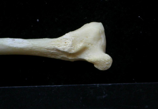 Fibula: distal part