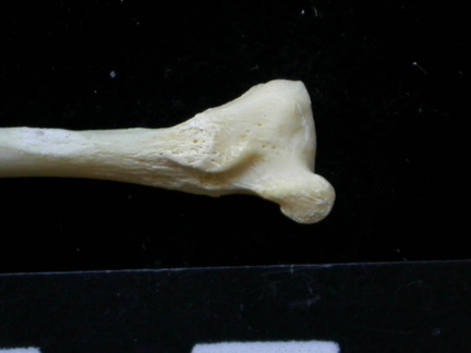 Fibula : partie distale