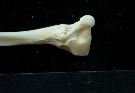 Fibula: distal part