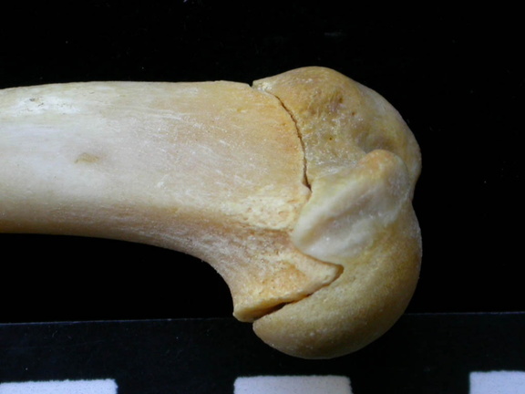 Humérus : partie proximale