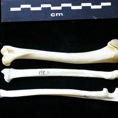 Humerus,radius and ulna