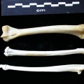 Humérus, radius et ulna