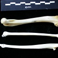 Humérus, radius et ulna