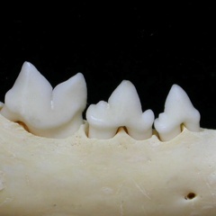 Dentición inferior