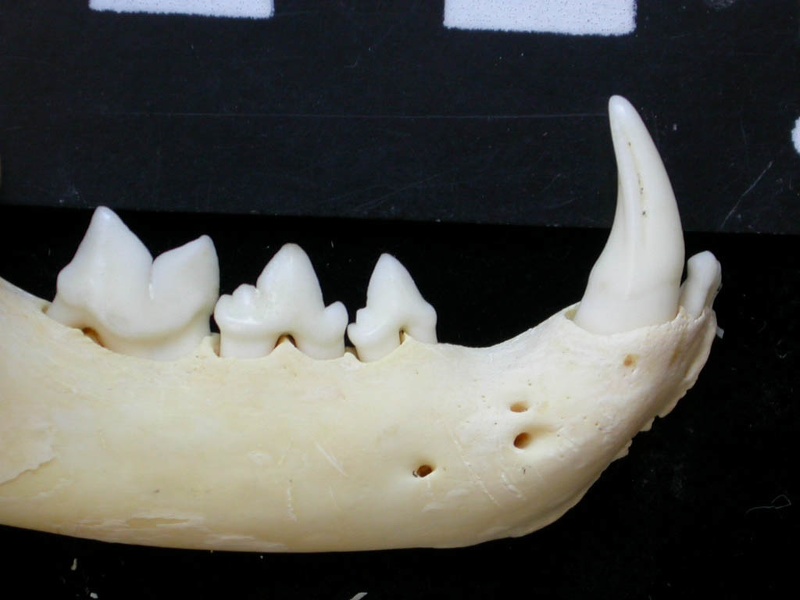 Dentition inférieure