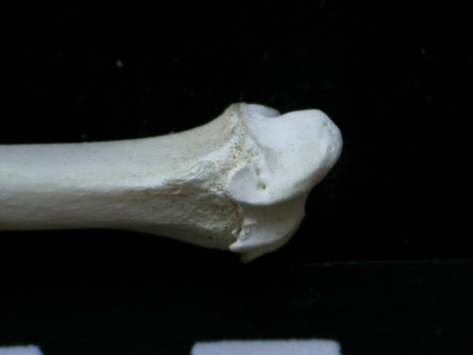 Radio : parte distal