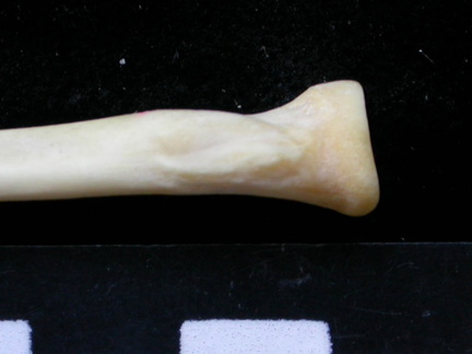 Radio : parte proximal