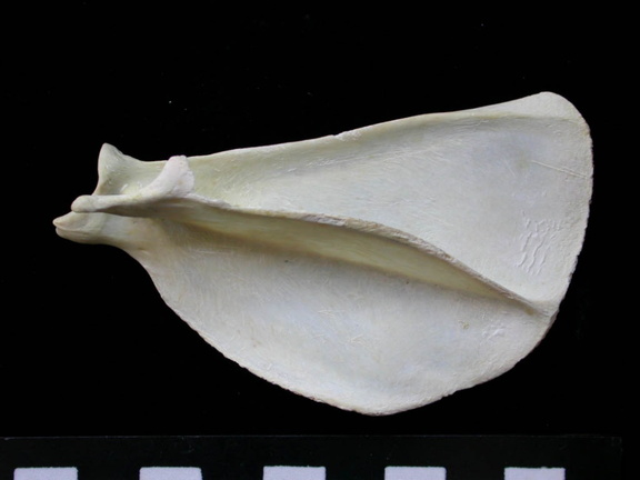 Scapula : vue latérale