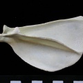Scapula : vue latérale