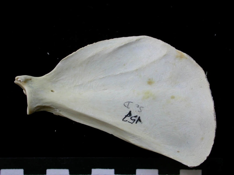 Scapula : vue médiale