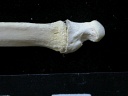 Ulna : partie distale