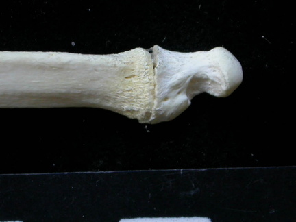 Ulna : partie distale