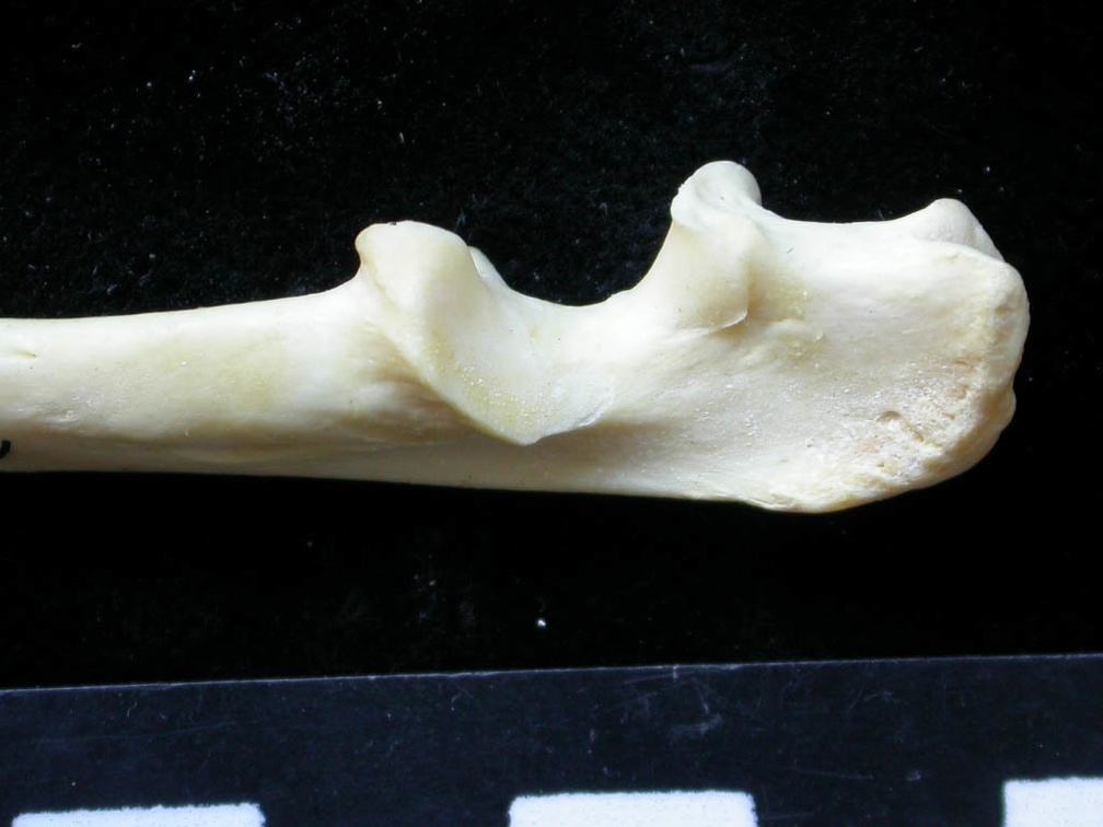  Ulna: proximale part