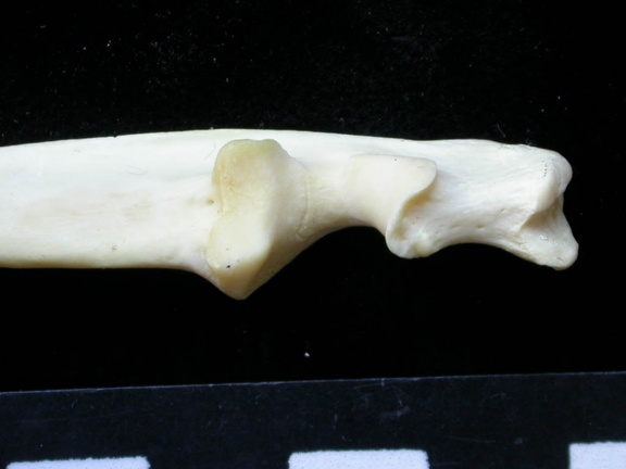  Ulna: proximale part