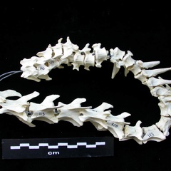 Vertebrae