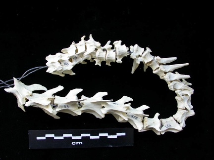 Vertebrae