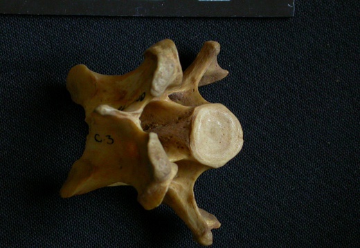 Cervical vertebrae