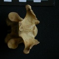 Cervical vertebrae