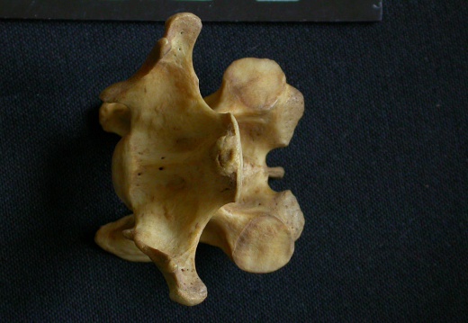 Cervical vertebrae