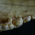 Dentition supérieure