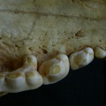 Hh-dentsup3.jpg