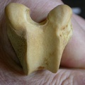 Femur: distal part